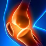 artritis-rodilla
